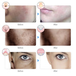 Nuvè LED Face Mask — 7-Color Red Light Therapy
